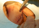 In addition, the epidermis is sutured with nylon thread.